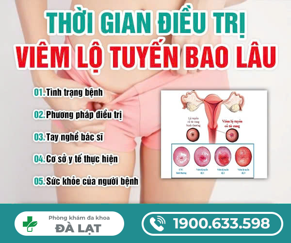 Hình ảnh minh họa